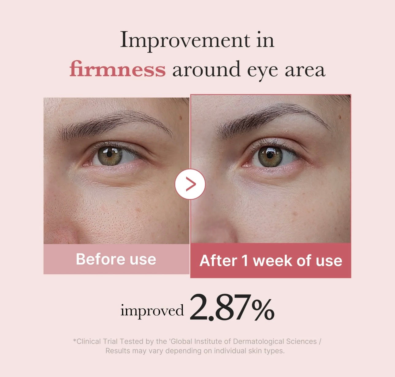 Medicube PDRN Pink Peptide Eye Cream 30ml