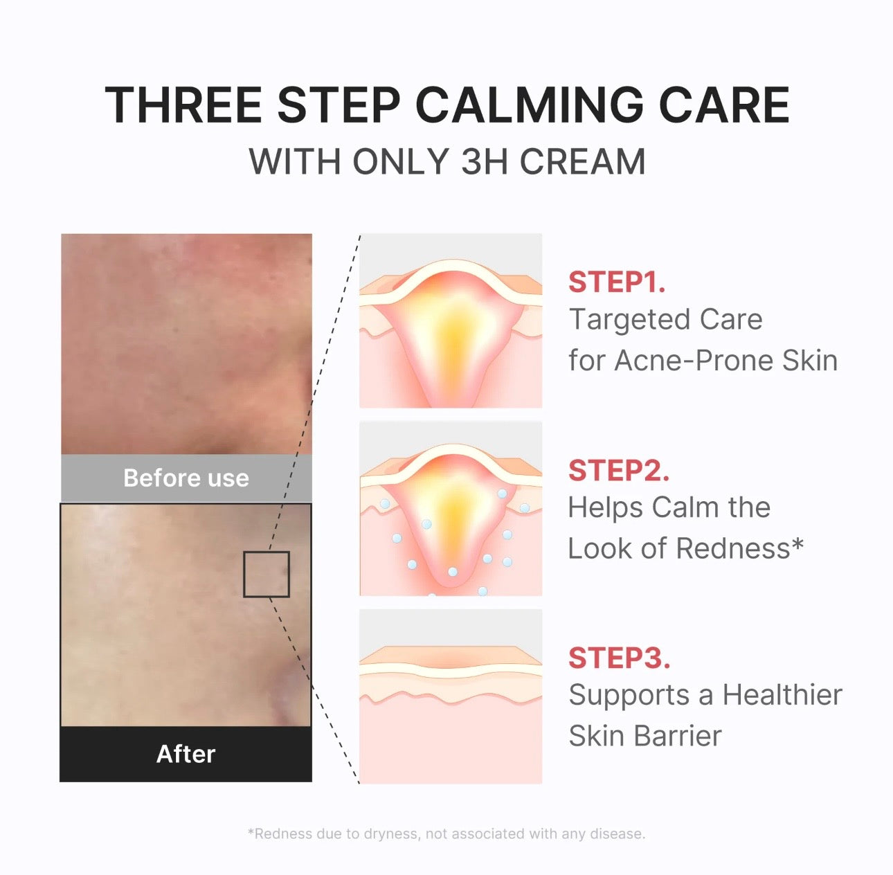 Medicube 3H Relief Cream 50ml