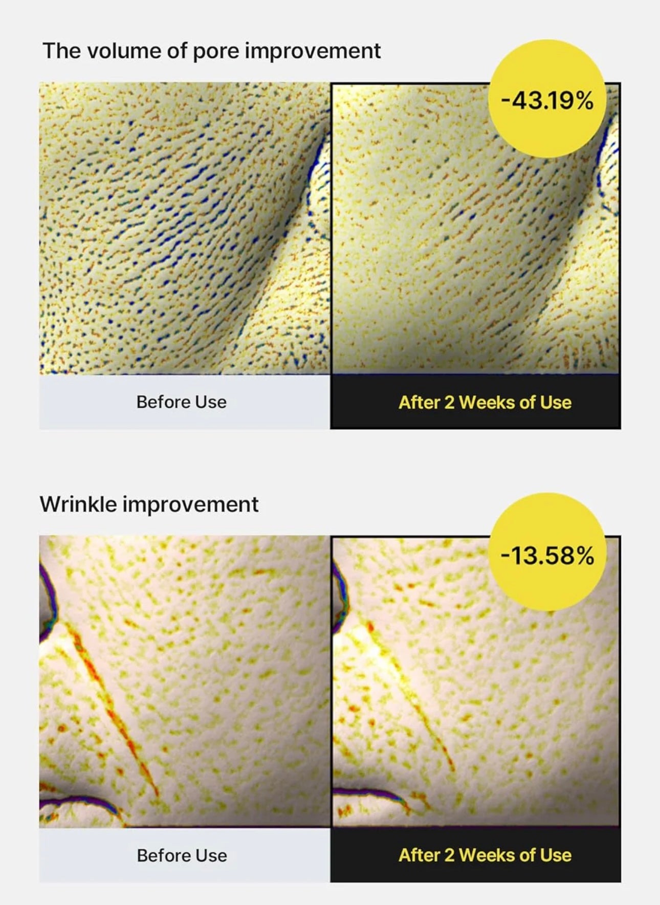 Gently applying Celimax Retinal Tightening Serum to face