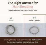 Applying Dr. Reju-All Advanced Hair Density Serum to scalp with metal ball