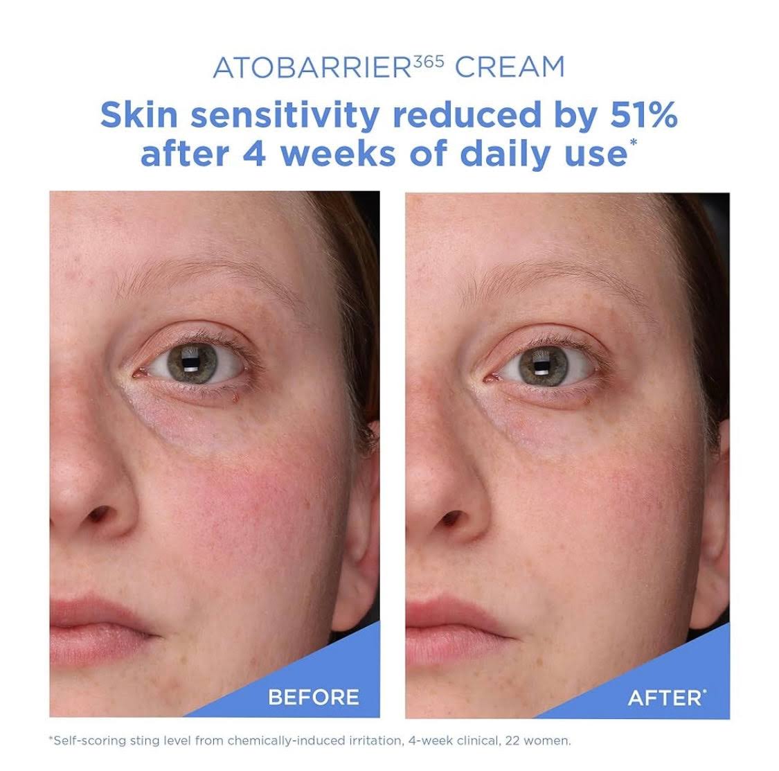 AESTURA Atobarrier 365 Bubble Cleanser (150ml)