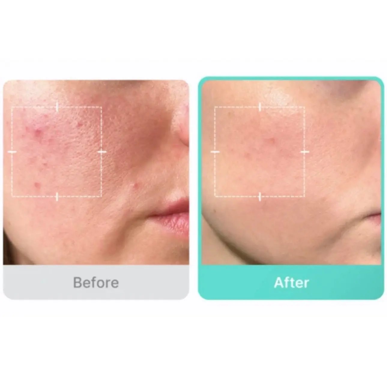 Medicube Azelaic Acid 16 BB Soothing Serum key ingredients – Niacinamide, Panthenol, Centella, and Ceramide