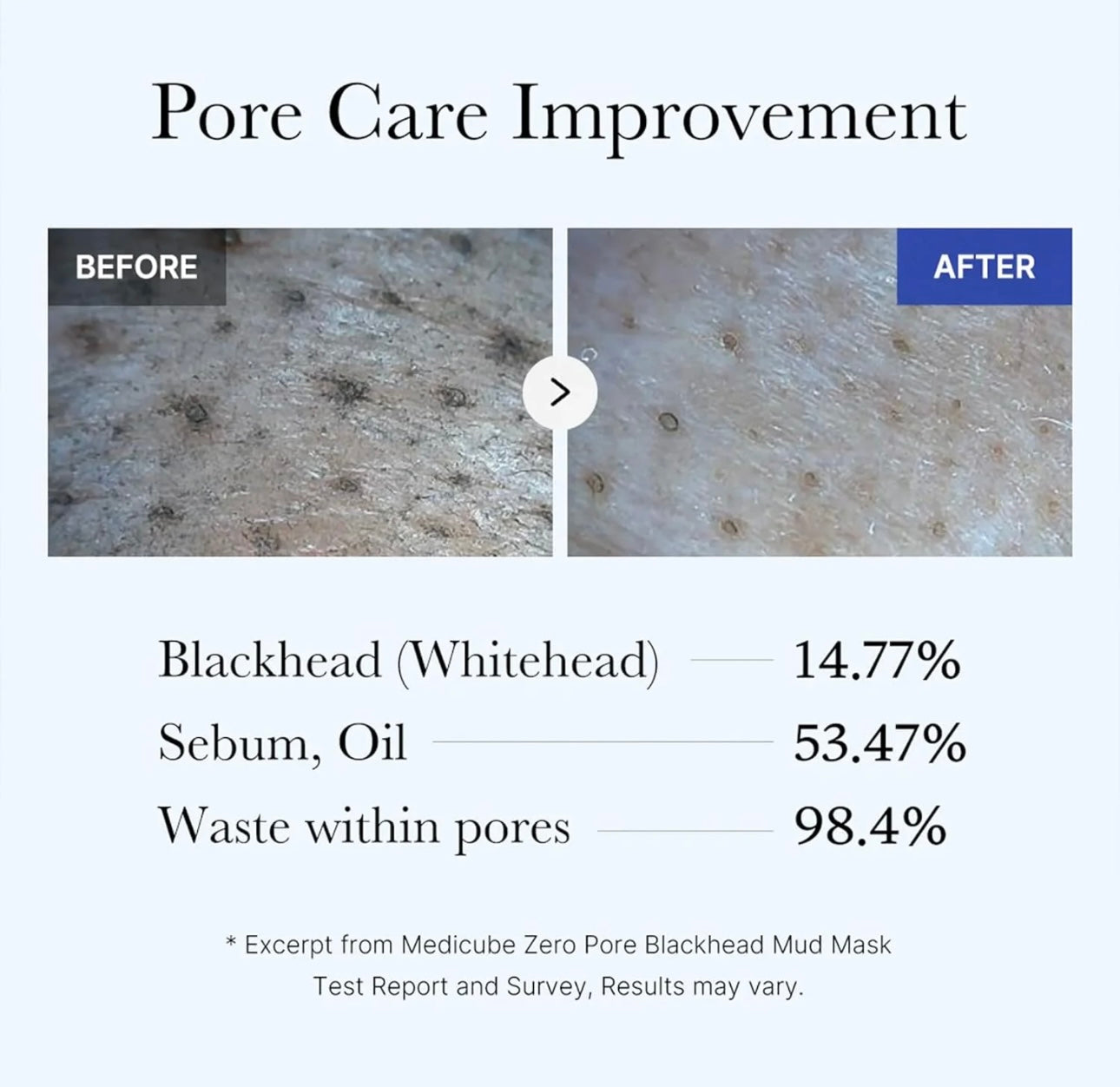 Before and after results using Medicube zero pore blackhead facial mask showing clean pores