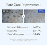 Before and after results using Medicube zero pore blackhead facial mask showing clean pores