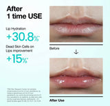Lips with a light glossy layer of anua pdrn lip serum, visibly plumper, smoother and deeply moisturized