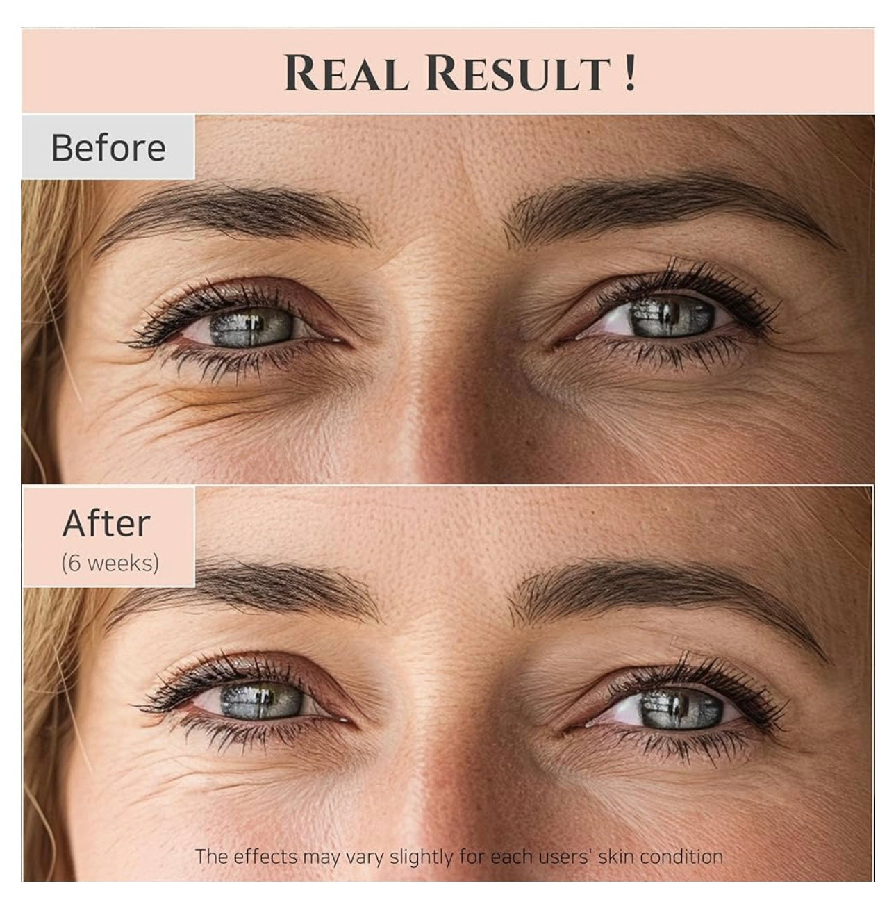 Label close-up showing 'retinal' (retinaldehyde) in Beauty of Joseon Revive Eye Serum — gentle vitamin A for anti-aging.