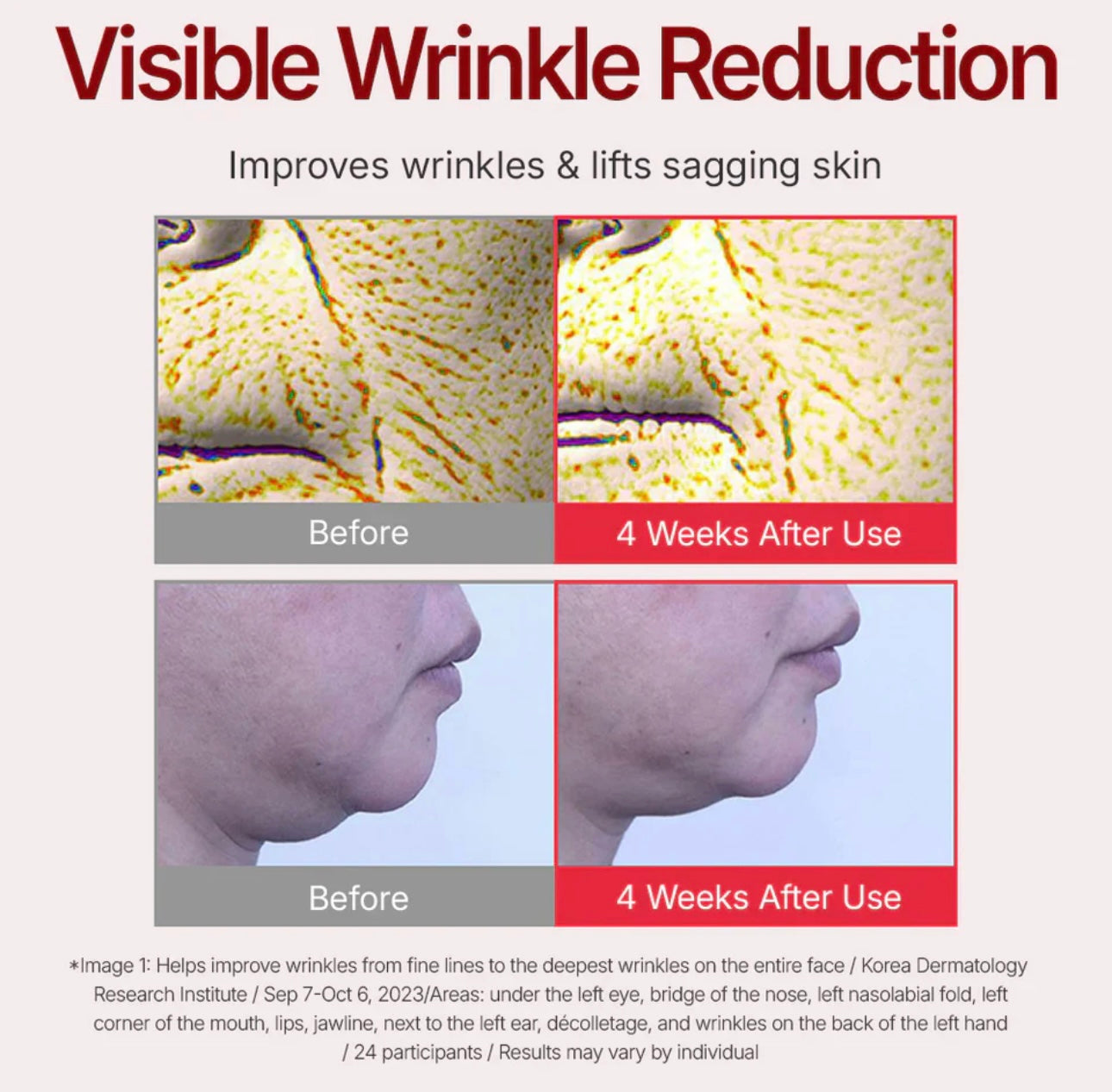 Woman gently applying Centellian24 Madeca Cream Time Reverse to her cheek for improved skin elasticity.