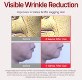Woman gently applying Centellian24 Madeca Cream Time Reverse to her cheek for improved skin elasticity.